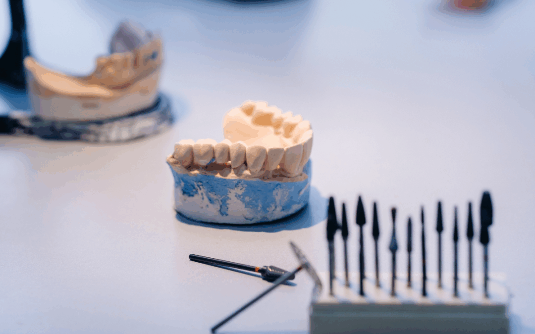 What Are “Shark Teeth” and Do They Need Treatment?