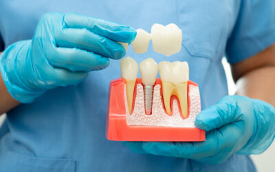 Can a Crown Save a Badly Damaged Tooth?